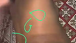 1000247514