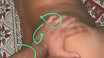 1000247514