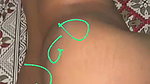 1000247514