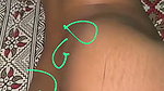1000247514