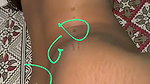1000247514