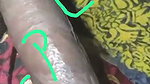 1000247513