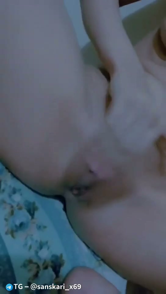 Frame 3