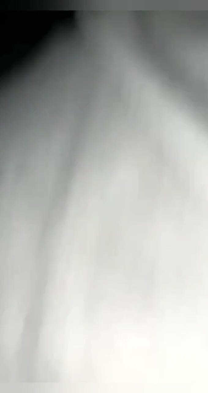 Frame 5