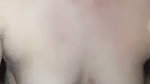 1000249940