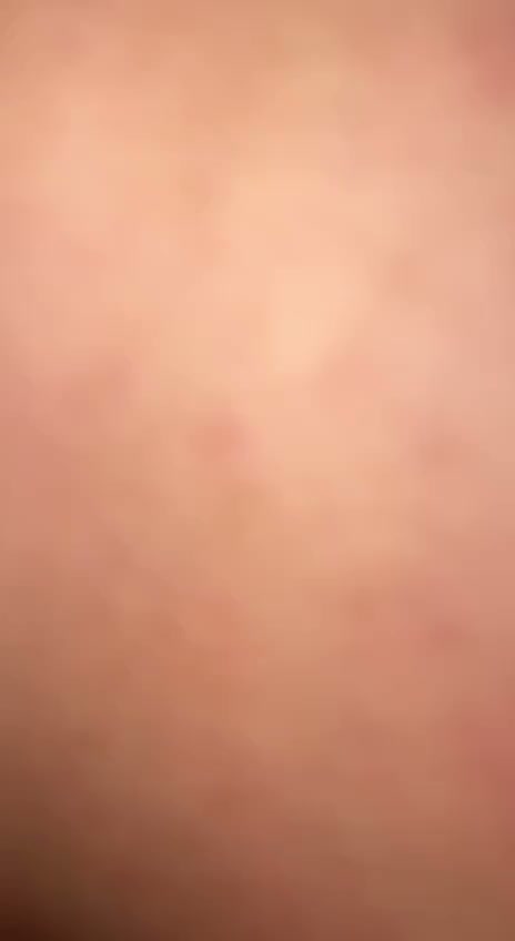 Frame 5