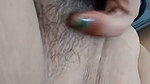 1000252026