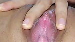 1000118529