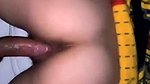 1000118526