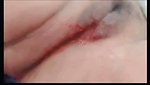 74076 girl in menses period