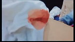 74076 girl in menses period