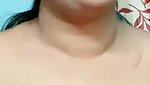 1000318795