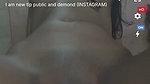 1000169355