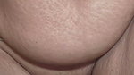 1000167650
