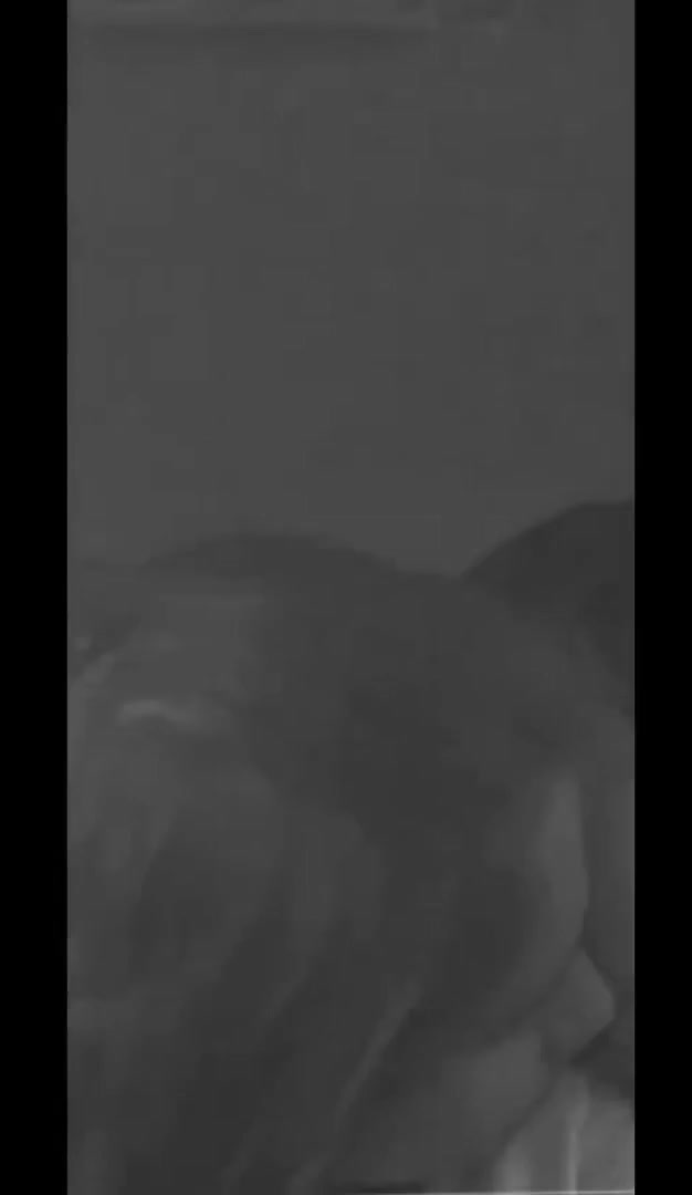 Frame 8