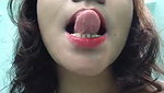 1000131862