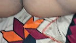 1000283914