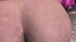 1000169376