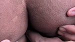 1000169376
