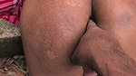1000169376