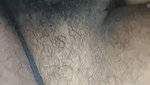 1000169867