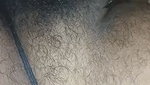 1000169867