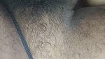 1000169867