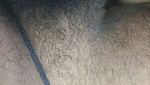 1000169867