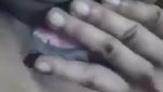 1000132755