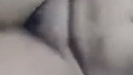 1000132755