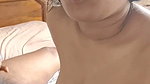 1000132729