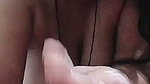 1000075099
