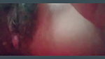 1000044692
