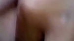 1000132704