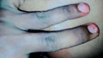 Husband drill his wife ass  blood come out