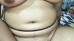 1000170332