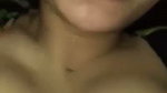 1000015402