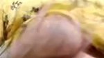 1000329395