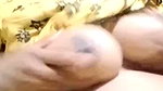 1000329395