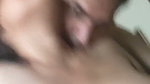 1000329377