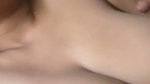 1000329377