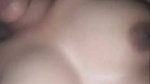 1000329335