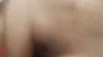 1000329355