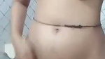 1000329355