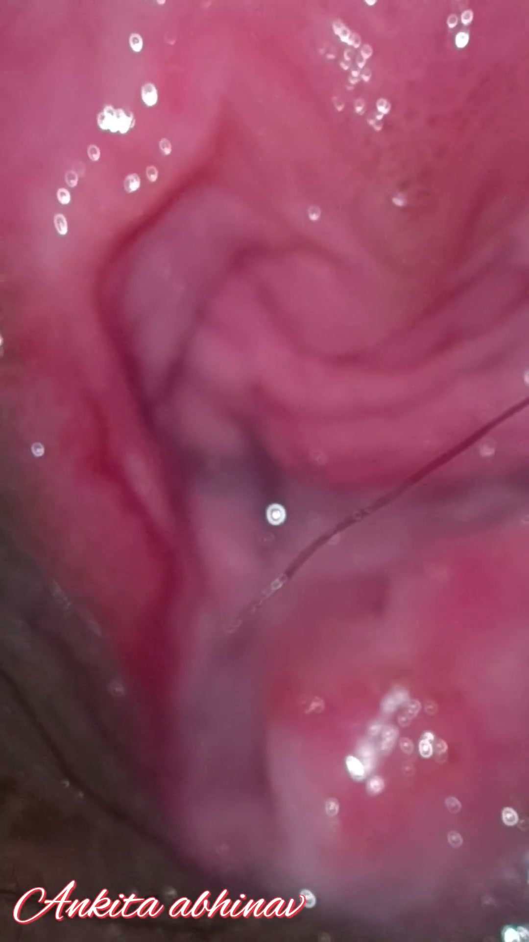 Frame 9