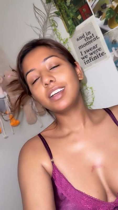 afat love bite