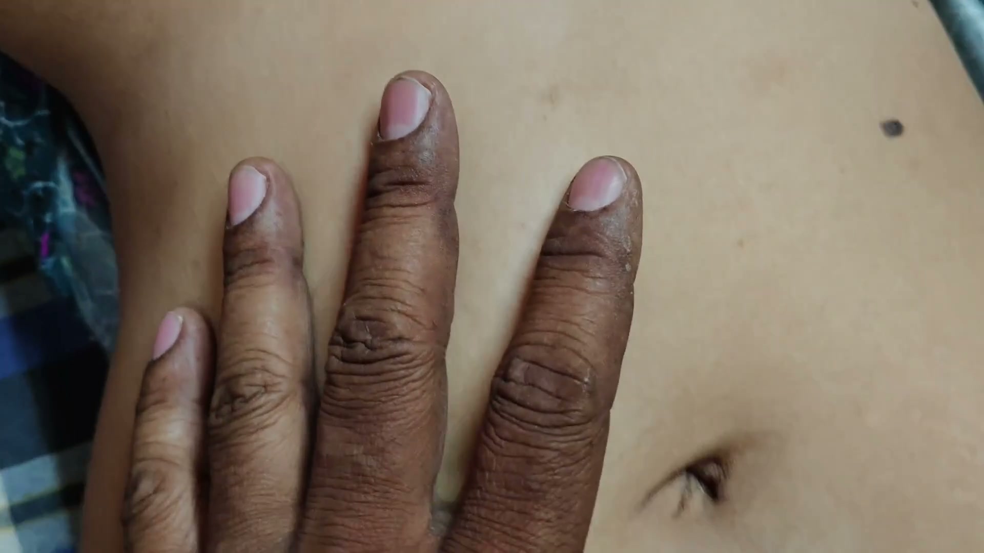 Frame 7