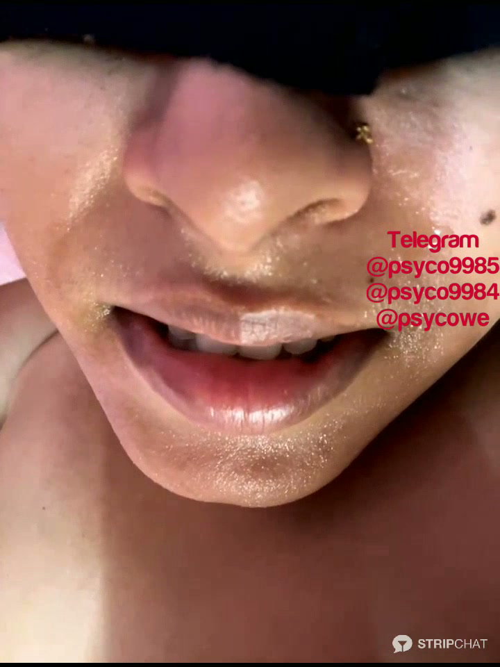 Frame 10
