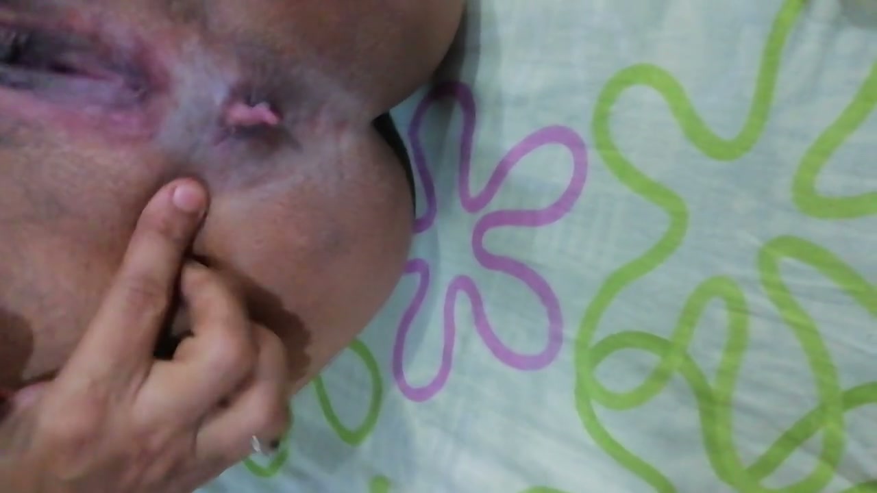 Frame 10