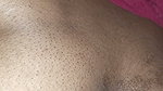 Dewormed my stepsister ass